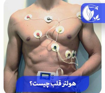 هولتر ریتم قلب