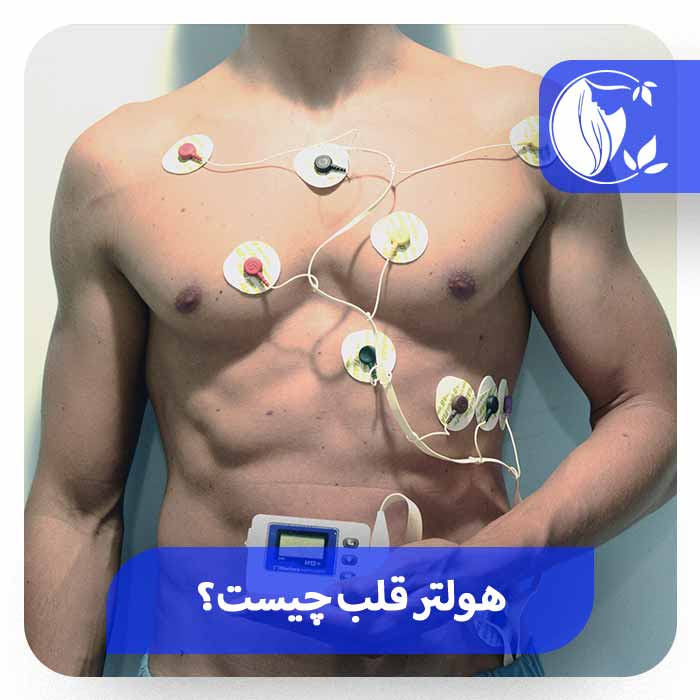 هولتر ریتم قلب