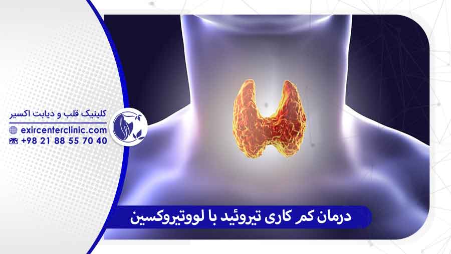 درمان کم کاری تیروئید