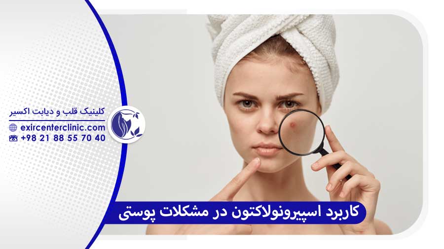 کاربرد قرص اسپیرونولاکتون در مشکلات پوستی