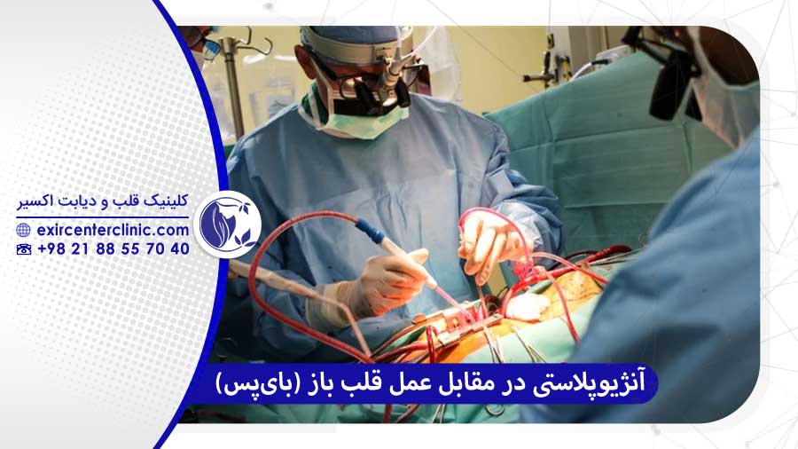 آنژیوپلاستی در مقابل عمل قلب باز (بای‌پس)