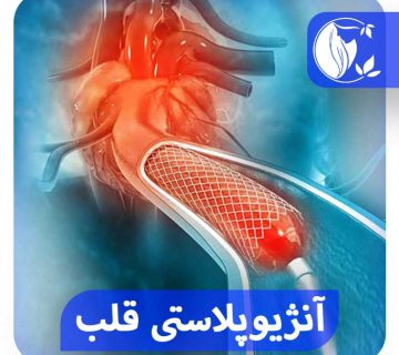 آنژیوپلاستی قلب
