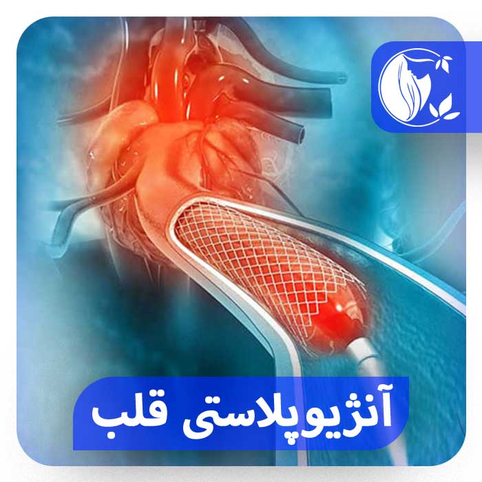 آنژیوپلاستی قلب