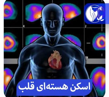 اسکن هسته‌‌ای قلب