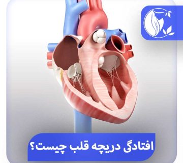 افتادگی دریچه قلب