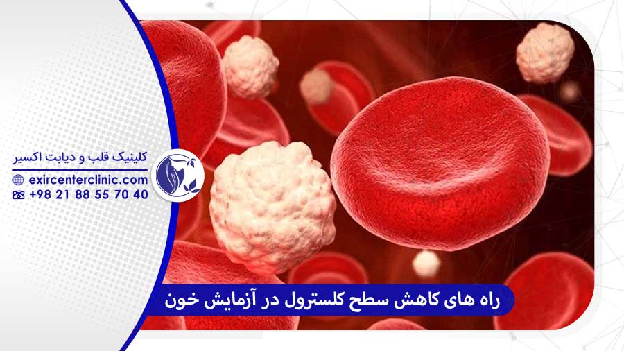 برای کاهش سطح کلسترول در آزمایش خون چه کار کنیم؟