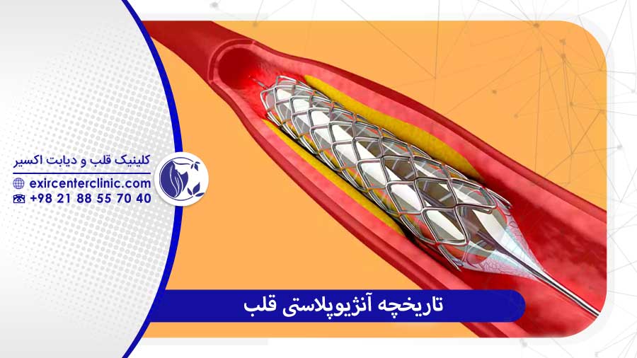 تاریخچه آنژیوپلاستی قلب
