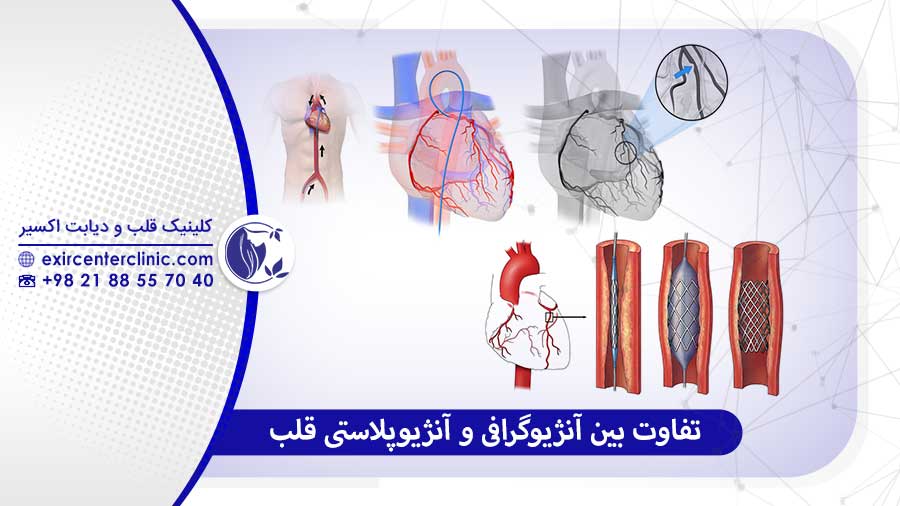 تفاوت بین آنژیوگرافی و آنژیوپلاستی قلب