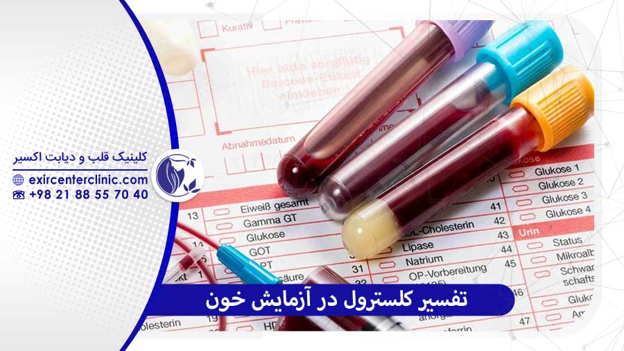 تفسیر کلسترول در آزمایش خون