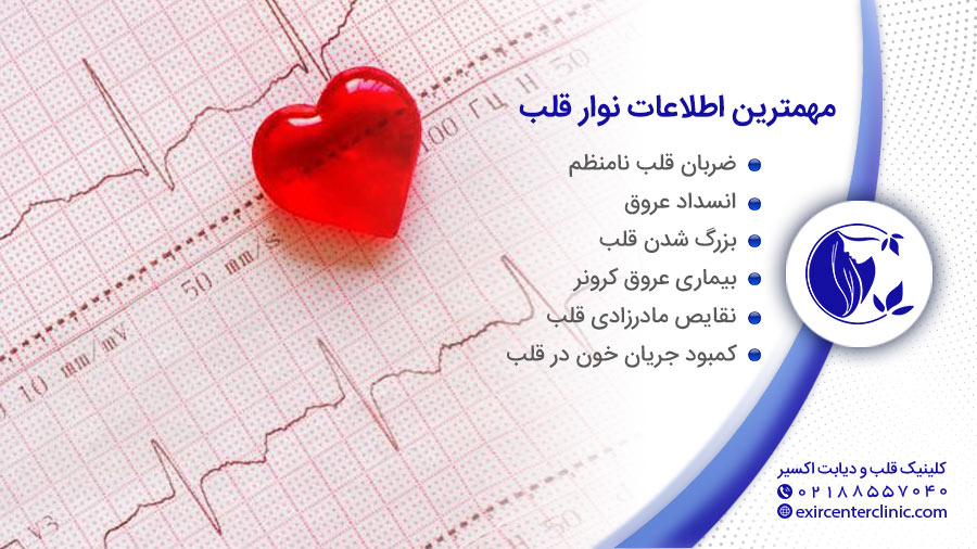 مهمترین اطلاعات نوار قلب