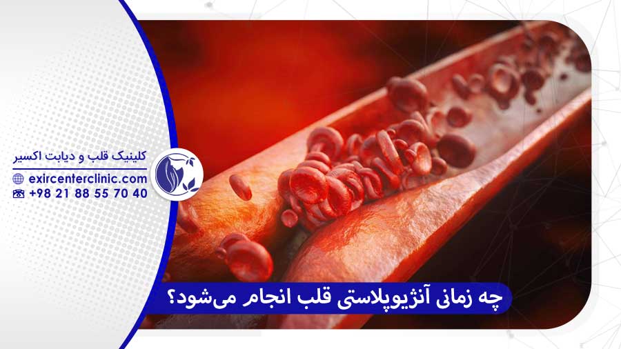چه زمانی آنژیوپلاستی قلب انجام می‌شود؟