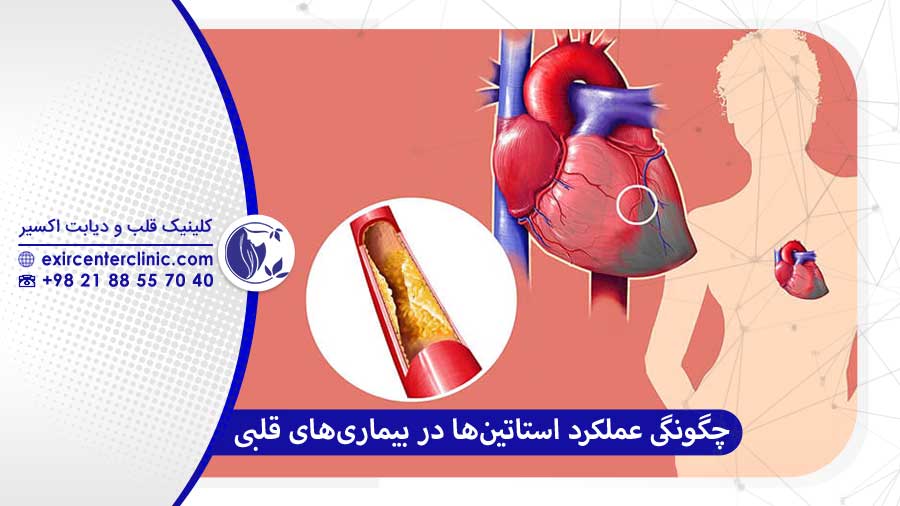 استاتین‌ها چگونه در بیماری‌های قلبی عمل می‌کنند؟