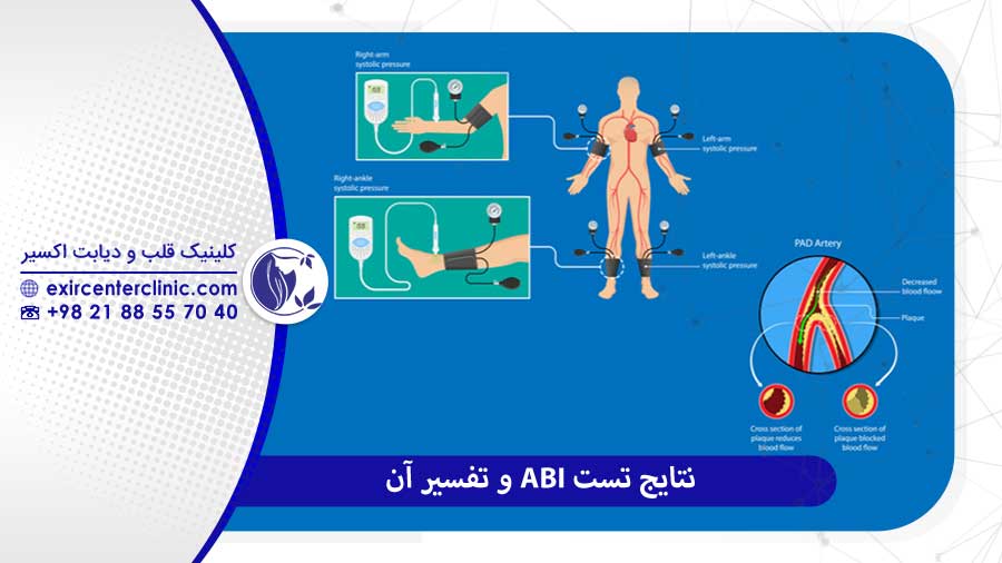 نتایج تست ABI و تفسیر آن