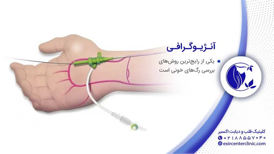 آنژیوگرافی