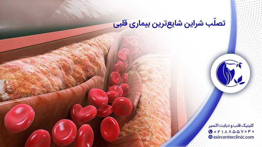 شایع‌ترین بیماری های قلبی و عروقی 