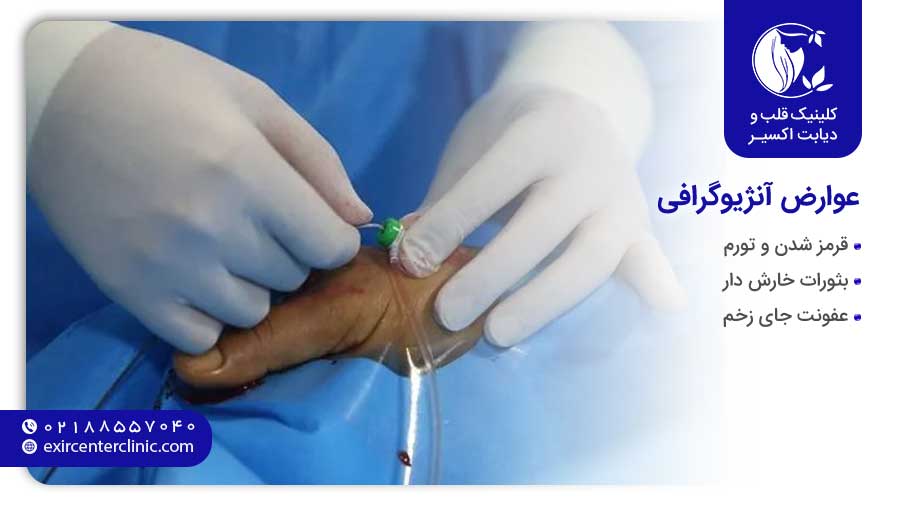 عوارض آنژیوگرافی