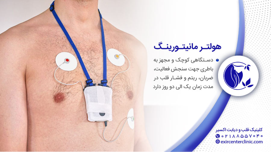 هولتر مانیتور