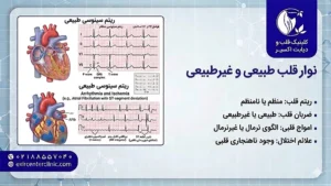 نوار قلب طبیعی و غیر طبیعی